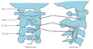 Cervical Spinal Pain